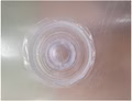 np-bladder-anti-twist-patch-140155-1.jpg